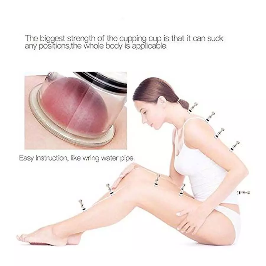 Vacuum Twist Suction Cupping Device Massage Relax Biomagnetic Chinese Cupping Therapy Set (4P-S)