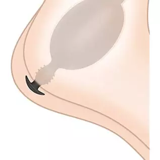 Inflatable Anal Plug Sex Toys with Detachable Needle Silicone Butt Plug Dildo Butt Expand Trainer Backdoor Stimulator SM Anus Se