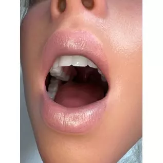 Scarlett GE95 170cm C Cup Moveable Jaw Zelex (5ft7)