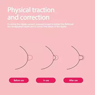Vacuum Suction Massage Cups-Nipple Corrector Stronger Suction for Flat and Inverted Nipples Vacuum Suction Massage Cups-Nipple Corrector Stronger Suction for Flat and Inverted Nipples
