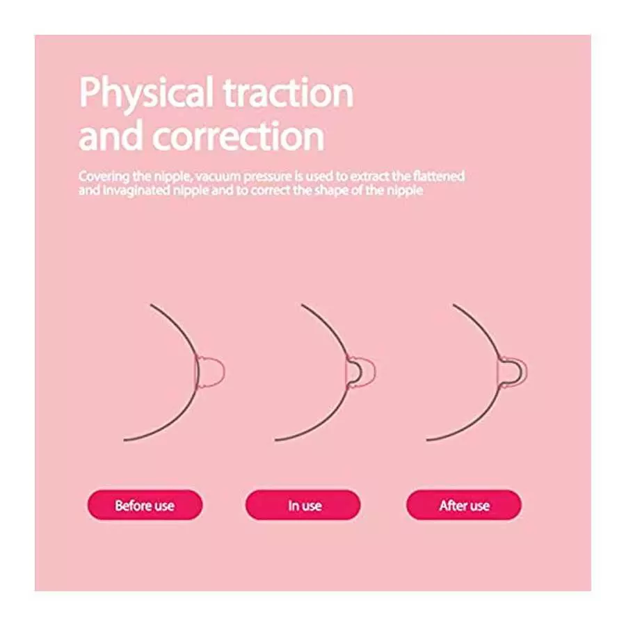Vacuum Suction Massage Cups-Nipple Corrector Stronger Suction for Flat and Inverted Nipples